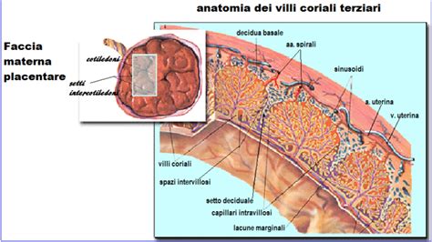 Immagine microscopica di villi coriali in una mola idatiforme