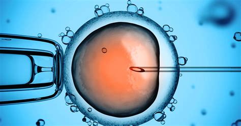 Principali fattori di successo della ICSI