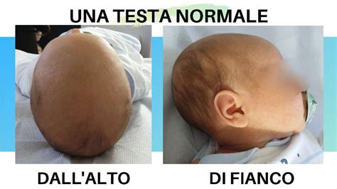 diagramma che illustra la corretta inclinazione della testa del neonato