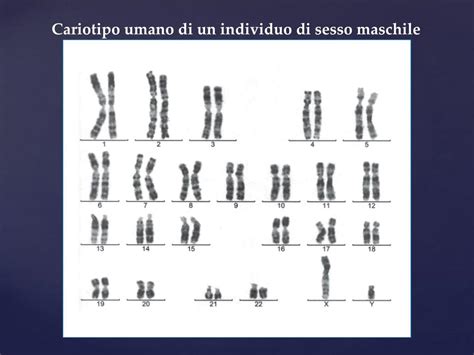 Immagine di un cariotipo umano con cromosomi