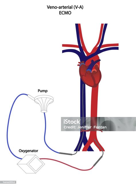Funzionamento di ECMO