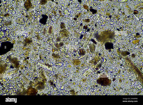 Microorganismi del suolo in un terreno vulcanico