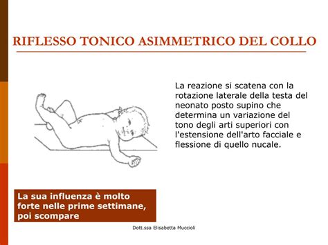 Esempio di riflesso tonico asimmetrico