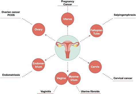 Diagram of the female reproductive system with common pathologies