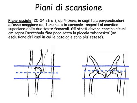 Piani di scansione della neurosonografia