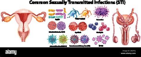 Infographic on sexually transmitted infections prevention