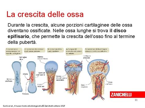 diagramma che illustra la posizione delle placche di crescita nelle ossa lunghe durante l'infanzia