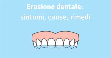 Dente con bordi traslucidi e segni di erosione