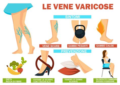 Fattori di rischio per vene varicose