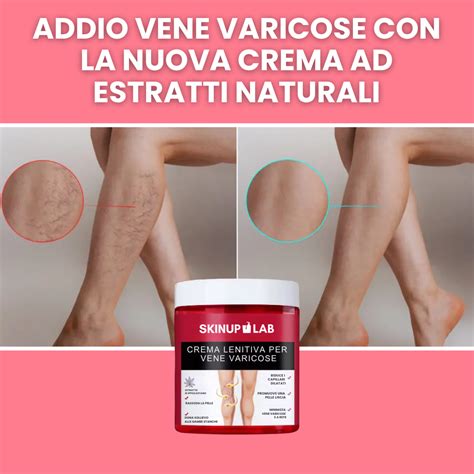 Etichetta di una crema per vene varicose con ingredienti