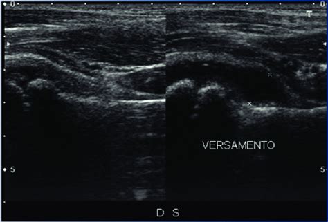 Struttura dell'articolazione coxo-femorale