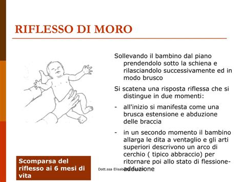 Schema delle fasi del riflesso di Moro
