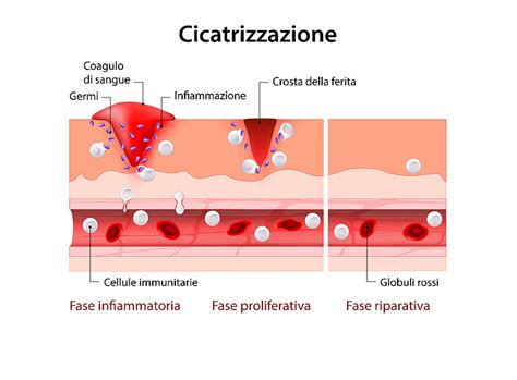 Diagramma che mostra il processo di guarigione di una ferita