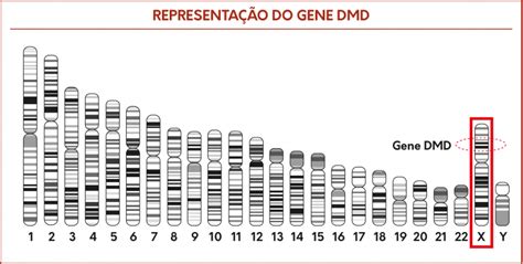 Struttura del gene DMD e della proteina distrofina