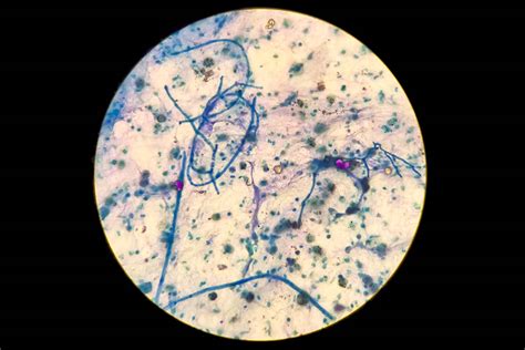 Candida albicans al microscopio