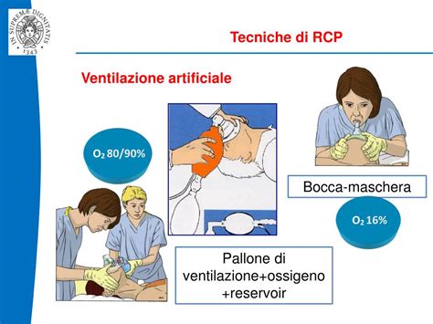 Tecniche di ventilazione neonatale