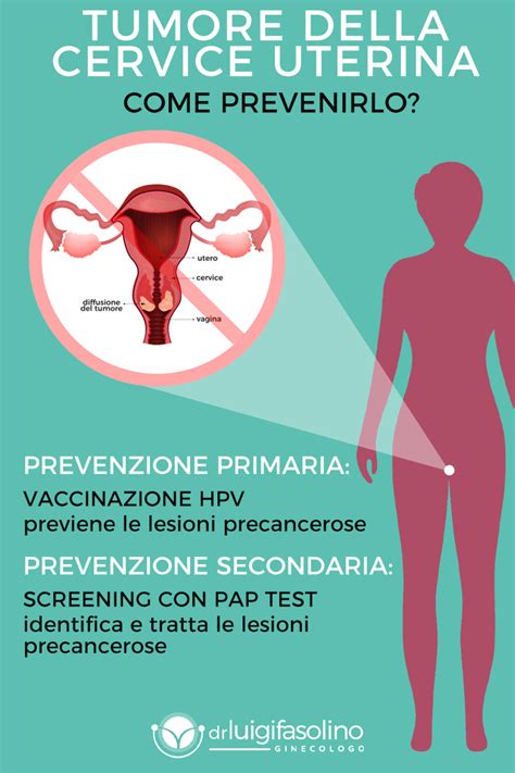 infografica sulle procedure di screening cervicale e prevenzione
