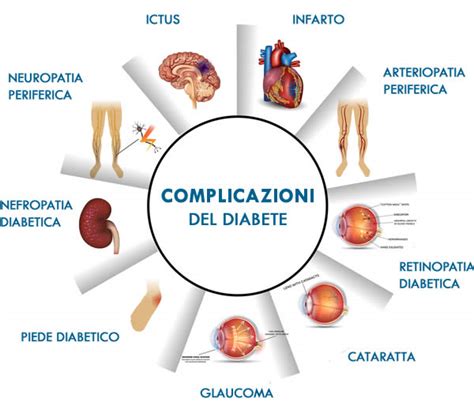 Rappresentazione schematico delle complicanze diabetiche in gravidanza