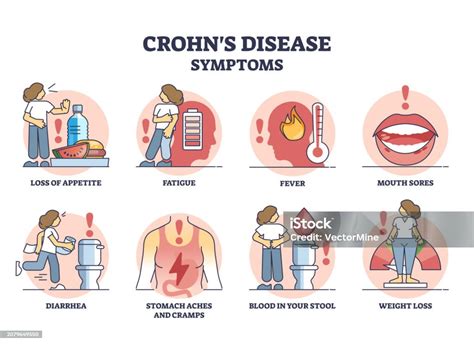 Grafico Morbo di Crohn sintomi