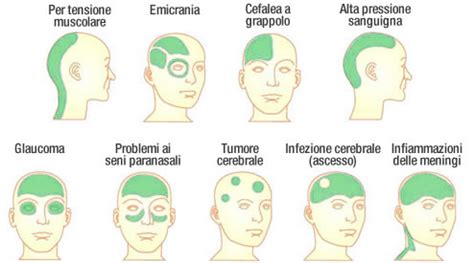 Donna che si tiene la testa per il mal di testa