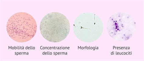 rappresentazione microscopica di spermatozoi sani e integri