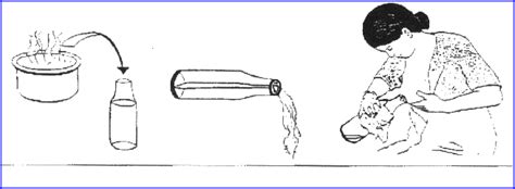 Diagramma di un seno con ingorgo mammario