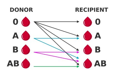 Donor matching illustration