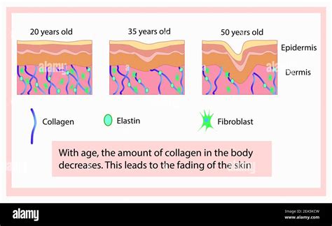 Schema anatomico della pelle con fibre di collagene ed elastina