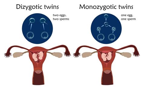 Formazione di gemelli omozigoti vs eterozigoti