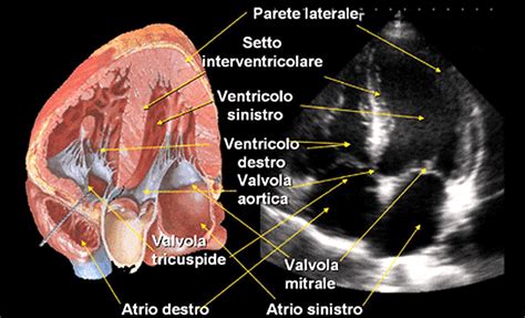Ecografia fetale: visualizzazione del cuore del feto con color doppler
