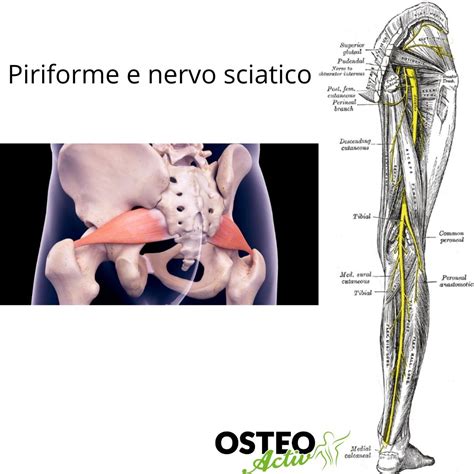 Relazione anatomica tra il muscolo piriforme e il nervo sciatico