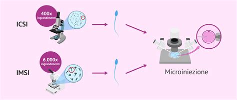 Microscopio con micromanipolatore per ICSI e IMSI
