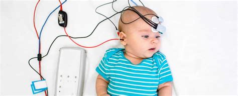 Esame ABR su neonato con elettrodi