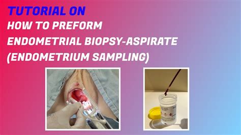 Biopsia endometriale