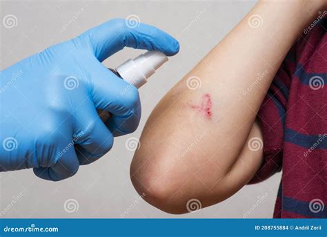 Person applying spray to a wound