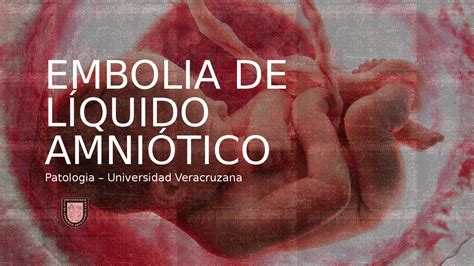 diagramma meccanismi embolia liquido amniotico