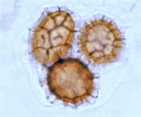 Microfotografia di spore di tartufo con ornamentazioni dell'episporio