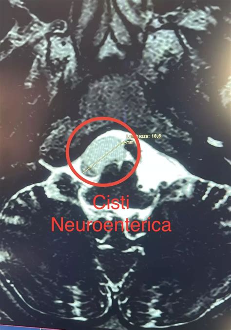 Diagnosi veterinaria di cisti uterine in una cavalla