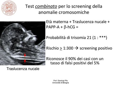 Schema del Test Combinato