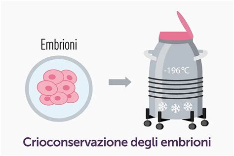 Schema illustrativo di un moderno laboratorio di crioconservazione e analisi cellulare
