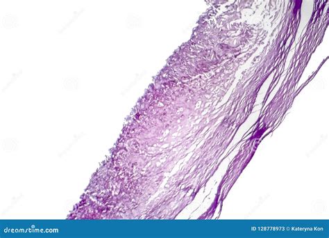 Microscopio che mostra i melanociti