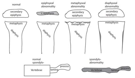 Diagramma che illustra i segmenti degli arti fetali: rizomelico, mesomelico, acromelico