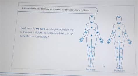 Diagramma che evidenzia le aree corporee più comunemente colpite da emangiomi infantili