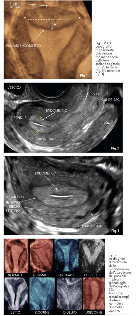 ecografia utero con gravidanza