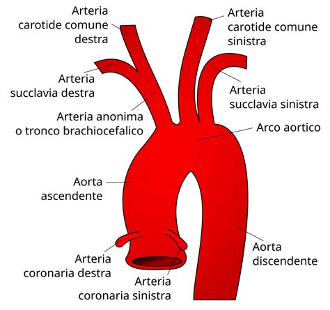 Schema dell'Arteria Succlavia Aberrante Destra (ARSA)