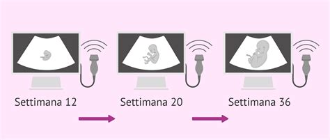 rappresentazione stilizzata dell'ecografia fetale durante la gravidanza