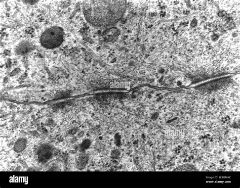Microscopio elettronico che mostra la struttura del DNA