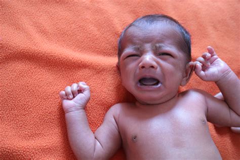 Neonato con cianosi alle estremità