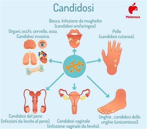 Prevenzione candida
