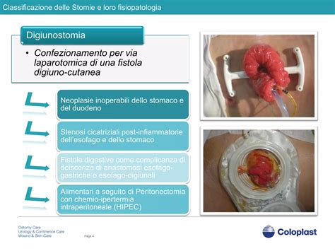 Immagine di vari accessori per la cura della stomia